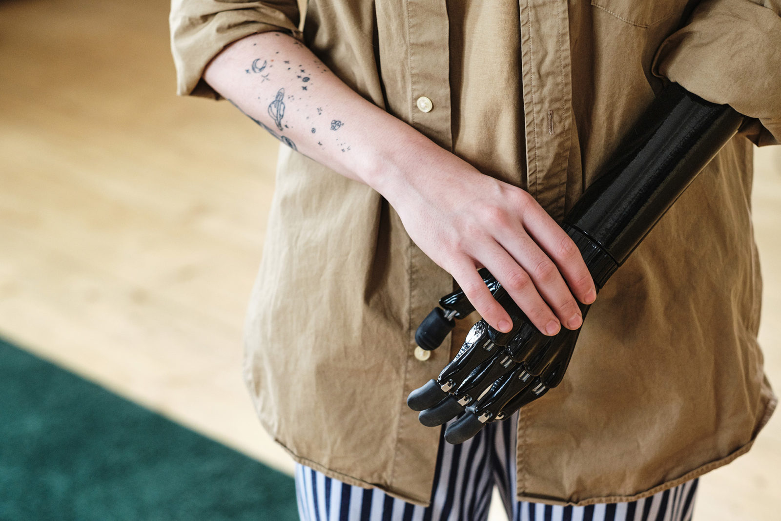 Young woman with prosthetic arm